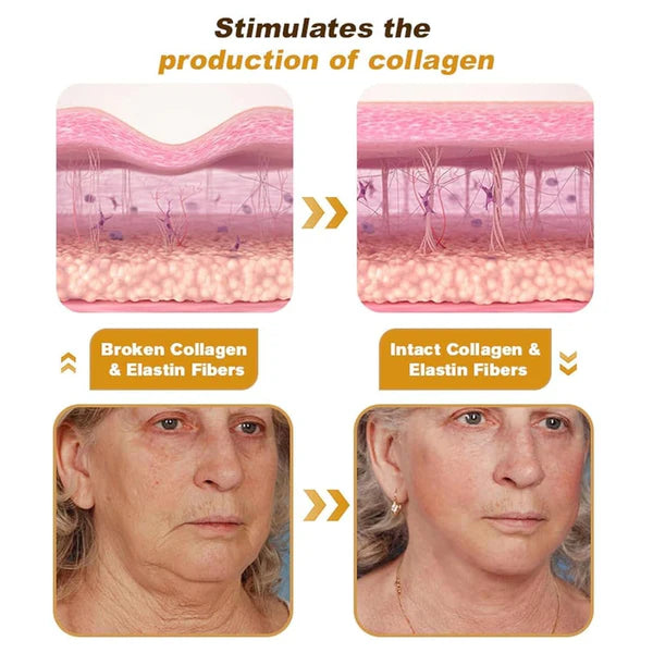 BOTOXIN BEE VENOM ANTI -AGEING CREAM (BUY 1 GET 1 FREE)